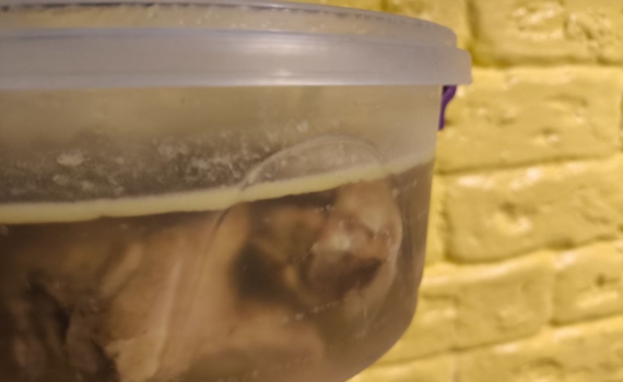 Забудьте о холодце: врач назвала бесполезные и полезные продукты для суставов